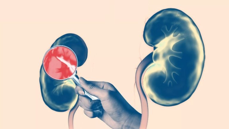 avances médicos, trasplante de órganos, xenotrasplante, donación de órganos, esperanza médica, innovación médica, calidad de vida, cuidados paliativos, FDA, cirugía experimental, bomba cardíaca mecánica, riñón de cerdo, timo, sistema inmunológico, Instituto de Trasplantes de NYU Langone, recuperación médica, compatibilidad de órganos, investigación médica, ética médica, bioética, bienestar animal